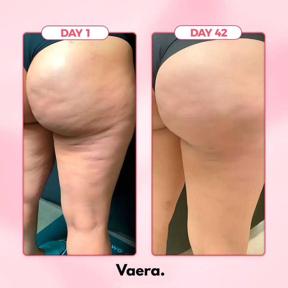 Anti Cellulite Massager™