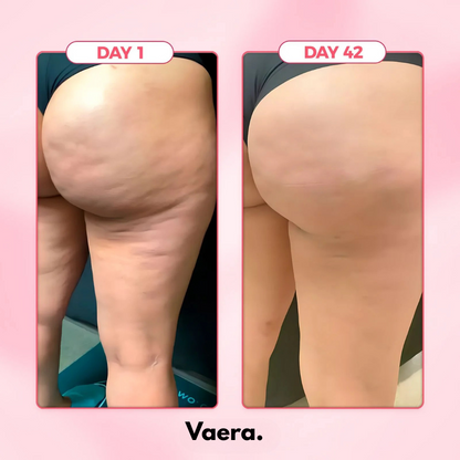 Anti Cellulite Massager™