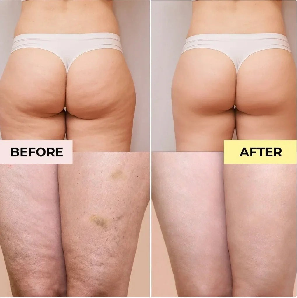 Glossay Anti-Cellulite Massage Oil: Smooth Skin, Firming, Hydrating, Natural Ingredients